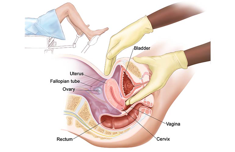 Gestation Trophoblastic Neoplasm (GTN)